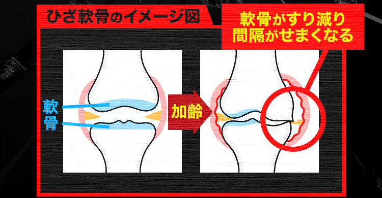 軟骨がすり減り間隔がせまくなる