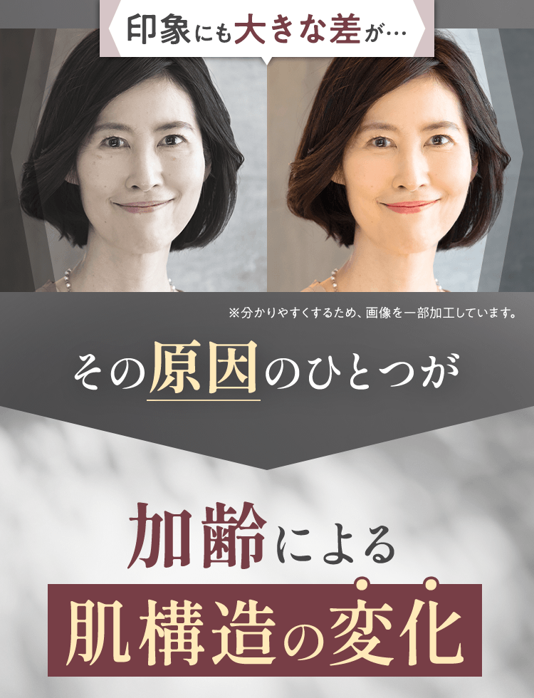 印象にも大きな差が…その原因のひとつが加齢による肌構造の変化