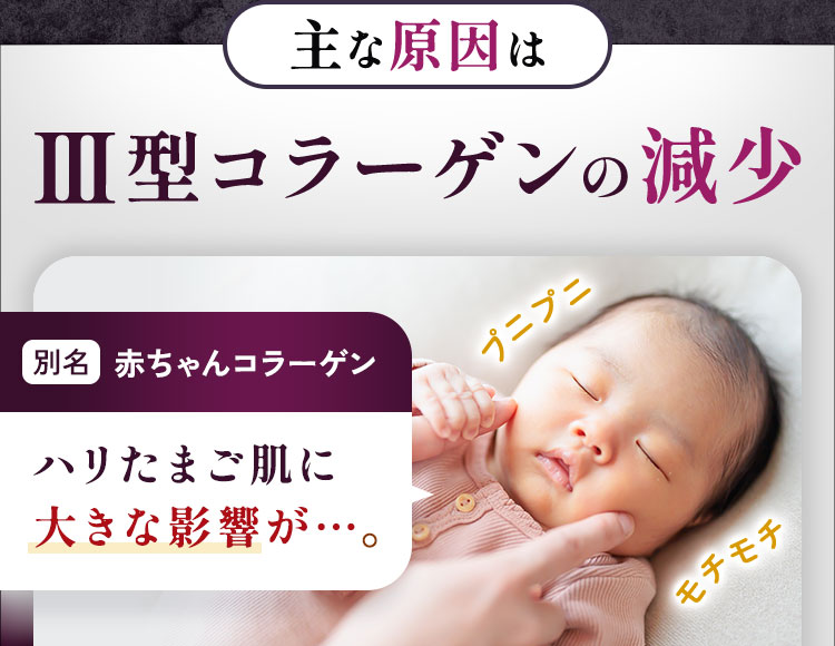 主な原因はⅢ型コラーゲンの減少